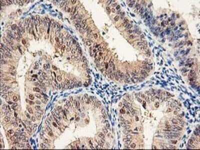 Immunohistochemistry: Proteasome subunit beta type 4 Antibody (OTI2C9) - Azide and BSA Free [NBP2-73655]