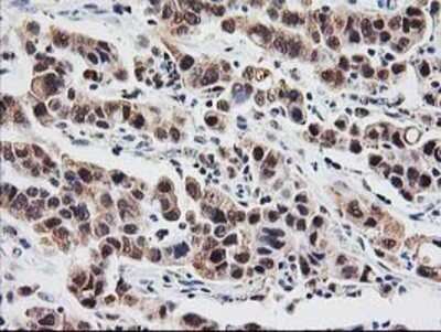 Immunohistochemistry: Proteasome subunit beta type 4 Antibody (OTI2C9) - Azide and BSA Free [NBP2-73655]
