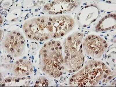 Immunohistochemistry: Proteasome subunit beta type 4 Antibody (OTI2C9) - Azide and BSA Free [NBP2-73655]