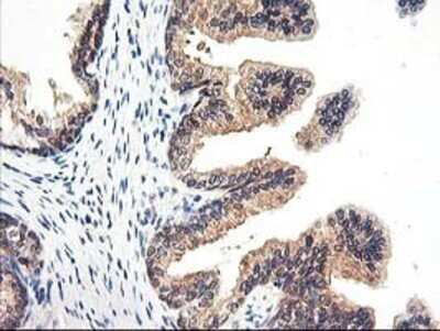 Immunohistochemistry: Proteasome subunit beta type 4 Antibody (OTI2C9) - Azide and BSA Free [NBP2-73655]