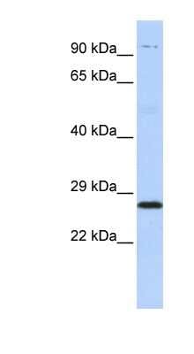 Western Blot: Proteasome subunit beta type 4 Antibody [NBP1-54592]