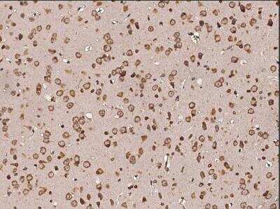 Immunohistochemistry-Paraffin: Protein Disulfide Isomerase/P4HB Antibody (023) [NBP2-90660]