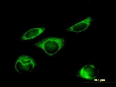 Immunocytochemistry/ Immunofluorescence: Protein Disulfide Isomerase/P4HB Antibody [H00005034-B01P]