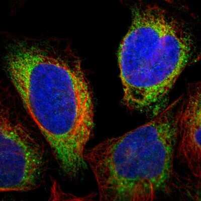 Immunocytochemistry/ Immunofluorescence: Protein Disulfide Isomerase/P4HB Antibody [NBP1-84051]