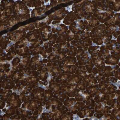 Immunohistochemistry-Paraffin: Protein Disulfide Isomerase/P4HB Antibody [NBP1-84051]