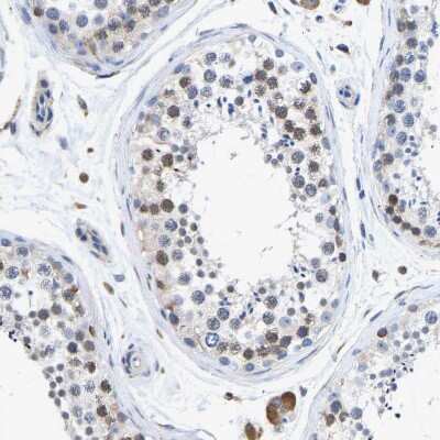 Immunohistochemistry-Paraffin: Protein Disulfide Isomerase/P4HB Antibody [NBP1-84051]
