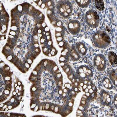 Immunohistochemistry-Paraffin: Protein Disulfide Isomerase/P4HB Antibody [NBP1-84051]