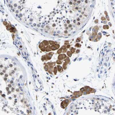 Immunohistochemistry-Paraffin: Protein Disulfide Isomerase/P4HB Antibody [NBP1-84051]