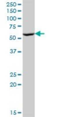 Western Blot: Protein Disulfide Isomerase/P4HB Antibody [H00005034-B01P]
