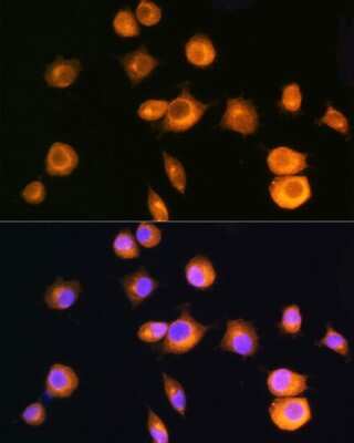 Immunocytochemistry/ Immunofluorescence: Protein Kinase A Regulatory Subunit II alpha Antibody - Azide and BSA Free [NBP3-03477]
