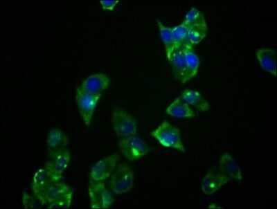 Immunocytochemistry/ Immunofluorescence: Protein Kinase A regulatory subunit I alpha Antibody (1C3) [NBP3-15192]