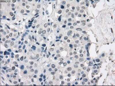 Immunohistochemistry-Paraffin: Protein Kinase A regulatory subunit I alpha Antibody (OTI6C7) [NBP1-47935]