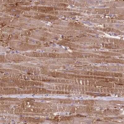 Immunohistochemistry-Paraffin: Protein Kinase A regulatory subunit I alpha Antibody [NBP2-33585]