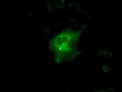 Immunocytochemistry/ Immunofluorescence: Protein Kinase A regulatory subunit I alpha Antibody (OTI6C7) - Azide and BSA Free [NBP2-73659]