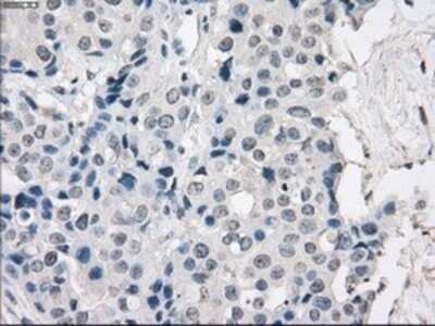 Immunohistochemistry: Protein Kinase A regulatory subunit I alpha Antibody (OTI6C7) - Azide and BSA Free [NBP2-73659]