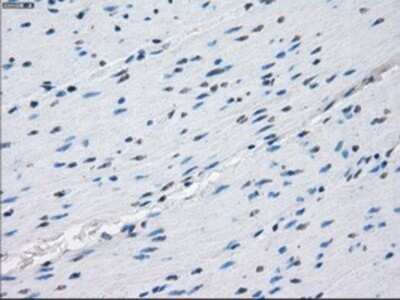 Immunohistochemistry: Protein Kinase A regulatory subunit I alpha Antibody (OTI6C7) - Azide and BSA Free [NBP2-73659]