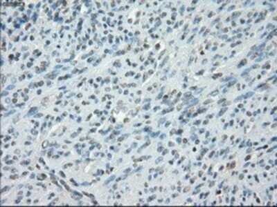 Immunohistochemistry: Protein Kinase A regulatory subunit I alpha Antibody (OTI6C7) - Azide and BSA Free [NBP2-73659]