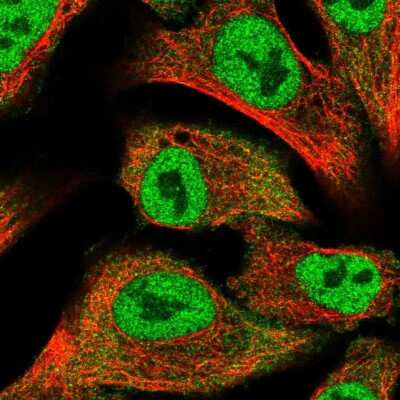 Immunocytochemistry/ Immunofluorescence: Protein Kinase D2 Antibody [NBP2-58315]