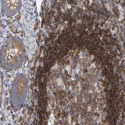 Immunohistochemistry-Paraffin: Protein Kinase D2 Antibody [NBP1-84139]
