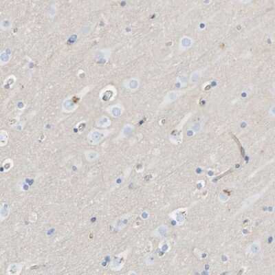 Immunohistochemistry-Paraffin: Protein Kinase D2 Antibody [NBP1-84139]