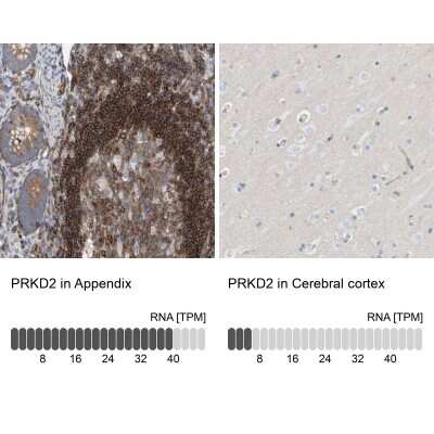 Immunohistochemistry-Paraffin: Protein Kinase D2 Antibody [NBP1-84139]