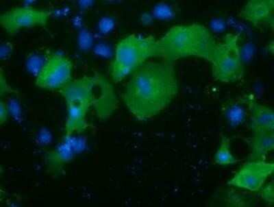 Immunocytochemistry/ Immunofluorescence: Protein Kinase D2 Antibody (OTI5G1) - Azide and BSA Free [NBP2-73664]