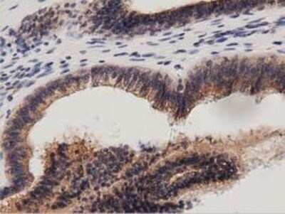 Immunohistochemistry: Protein Kinase D2 Antibody (OTI5G1) - Azide and BSA Free [NBP2-73664]