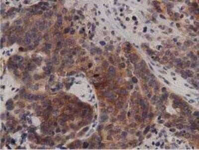 Immunohistochemistry: Protein Kinase D2 Antibody (OTI5G1) - Azide and BSA Free [NBP2-73664]