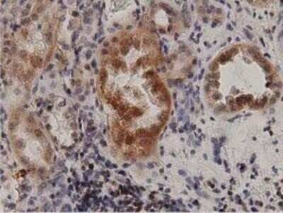 Immunohistochemistry: Protein Kinase D2 Antibody (OTI5G1) - Azide and BSA Free [NBP2-73664]