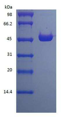 SDS-PAGE: Recombinant Protein L Type 1 His (N-Term) Cys (C-Term) Protein [NBP2-35050]