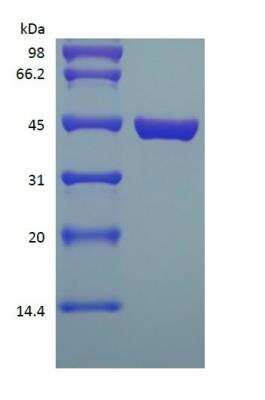SDS-PAGE: Recombinant Protein L Type 1 Protein [NBP2-35048]