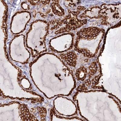 Immunohistochemistry: Protein O-Glucosyltransferase 1/POGLUT1/KTELC1 Antibody [NBP2-68633]