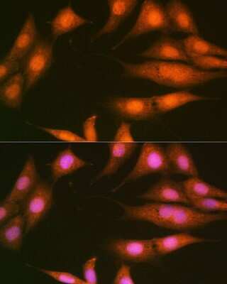 Immunocytochemistry/ Immunofluorescence: Protein Phosphatase 1 beta Antibody (5O9E7) [NBP3-16389]