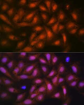Immunocytochemistry/ Immunofluorescence: Protein Phosphatase 1 beta Antibody (5O9E7) [NBP3-16389]