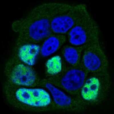 Immunocytochemistry/ Immunofluorescence: Protein Phosphatase 1 beta Antibody (8A7C7) - BSA Free [NBP2-52539]