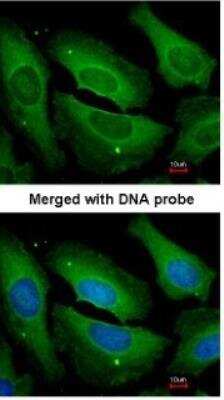 Immunocytochemistry/ Immunofluorescence: Protein Phosphatase 1C gamma Antibody [NBP1-32858]