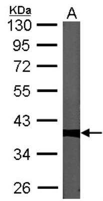 Western Blot: Protein Phosphatase 1C gamma Antibody [NBP1-32858]
