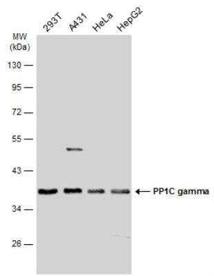 Western Blot: Protein Phosphatase 1C gamma Antibody [NBP1-32858]