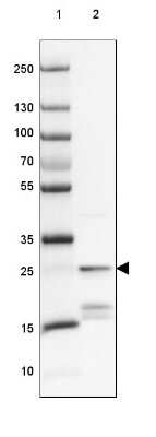 Western Blot: Protein Phosphatase inhibitor 1 Antibody [NBP2-37895]