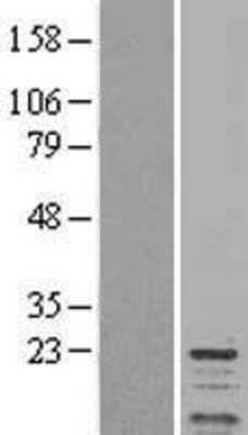 Western Blot: Protein Phosphatase inhibitor 1 Overexpression Lysate [NBL1-14678]