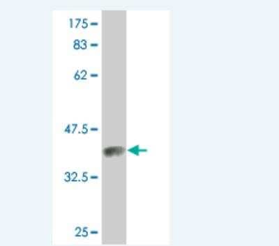 Western Blot: Protein S/PROS1 Antibody (3D7) [H00005627-M01]