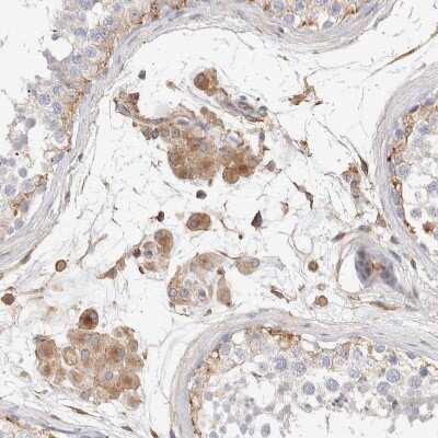 Immunohistochemistry-Paraffin: Protein S/PROS1 Antibody [NBP1-87217]