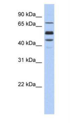 Western Blot: Protein S/PROS1 Antibody [NBP1-59165]
