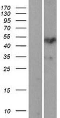 Western Blot: Protein Z Overexpression Lysate [NBP2-04259]