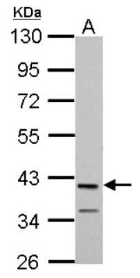 Western Blot: Protein mab-21-like 1 Antibody [NBP2-19961]
