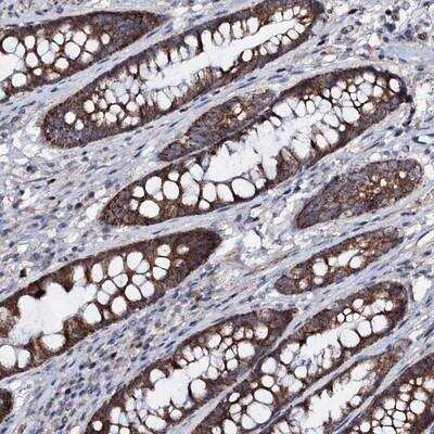 Immunohistochemistry-Paraffin: Protein phosphatase 1 inhibitor 3D Antibody [NBP1-87235]