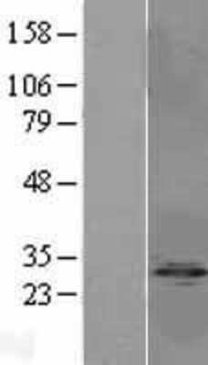 Western Blot: PP1 Inhibitor-2 Overexpression Lysate [NBL1-14682]