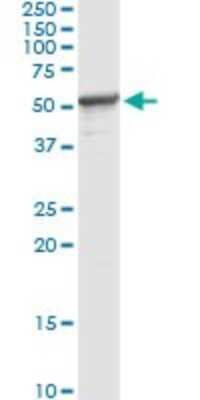 Immunoprecipitation: Protein phosphatase 1F Antibody (1G10) [H00009647-M02]