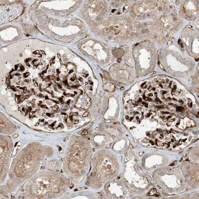 Immunohistochemistry-Paraffin: Protein phosphatase 1F Antibody [NBP1-88207]