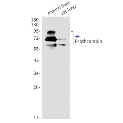 Western Blot: Prothrombin Antibody (S08-5G1) [NBP3-20051]